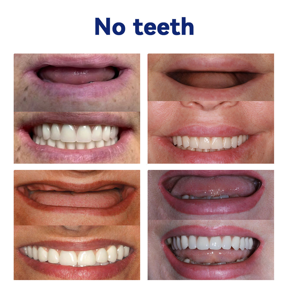 Bikenda™ Silicone Denture Ruler Set (👩🔬 CED Compliant Approved By Professional Dentists)