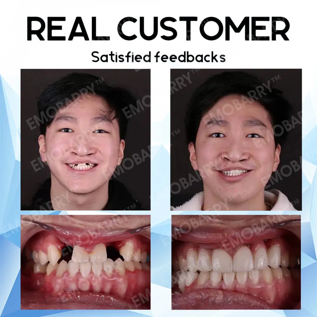 Bikenda™ Premium Custom Silicone Denture Set 💎✨ ADA (American Dental Association) Certified 🏅 Limited Time Discount Unlock a Perfect Smile 😁🦷 with our ADA-certified silicone dentures!