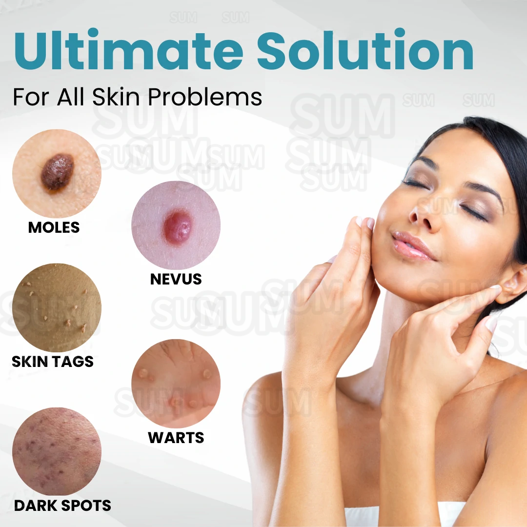 ✨Bikenda®Non-Invasive Skin Imperfection Removal Pen✨
