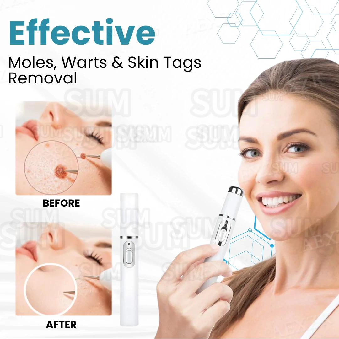 ✨Bikenda®Non-Invasive Skin Imperfection Removal Pen✨