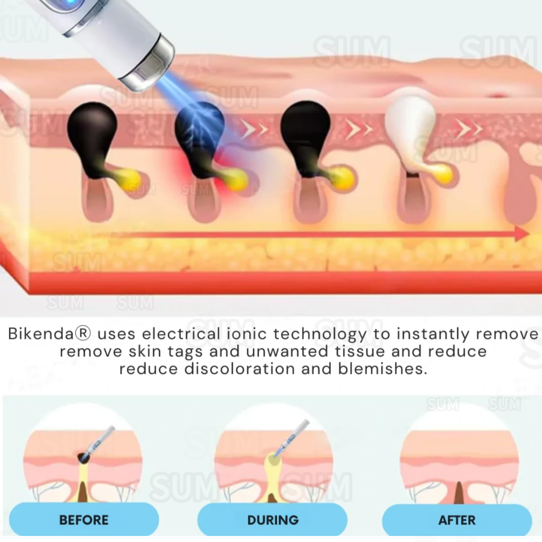 ✨Bikenda® Neinvazivní Tužka na Odstranění Kožních Nedokonalostí✨