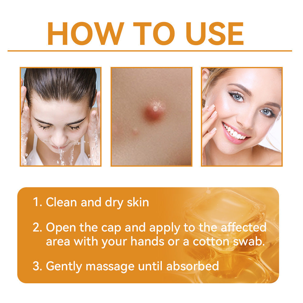 Tnnedey™ Bee Venom🐝 Skin Treatment Cream (AAD Recommended) ✨💆♀️ (Expert Recommended)