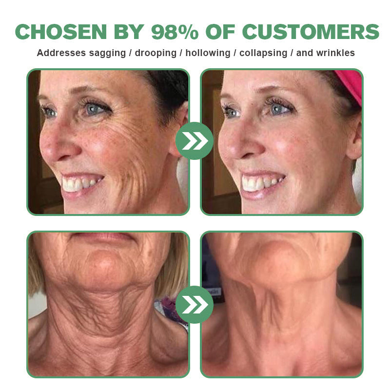 FDA Approved✨𝓕𝓾𝓫𝓼𝓽𝓪™ Botox Bee Venom Wrinkle Removal Serum-Last Day Promotion 75% OFF👩⚕️✨