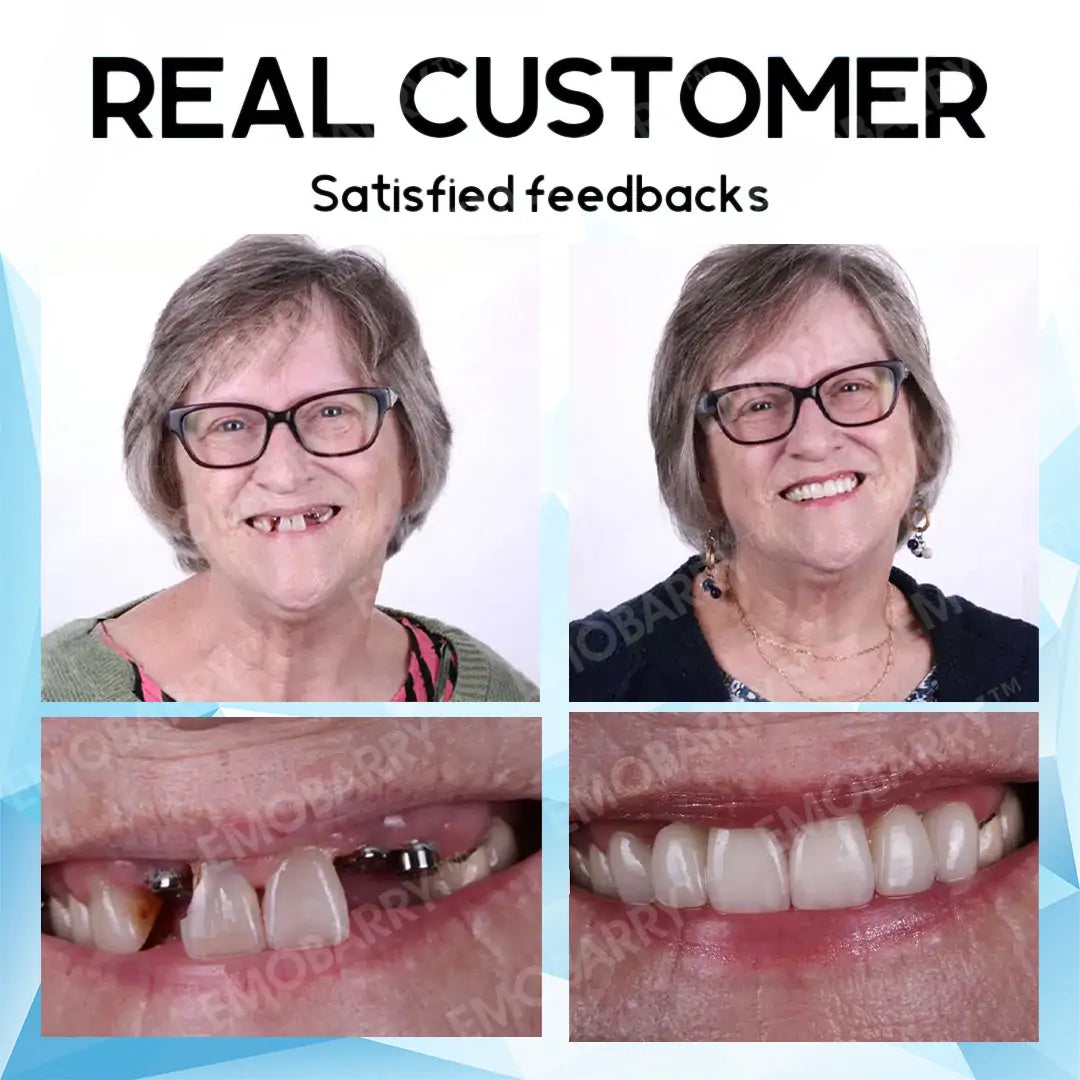 Bikenda™ Premium Custom Silicone Denture Set 💎✨ ADA (American Dental Association) Certified 🏅 Limited Time Discount Unlock a Perfect Smile 😁🦷 with our ADA-certified silicone dentures!