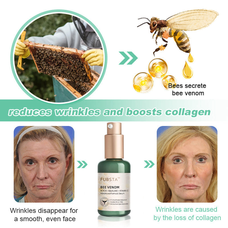 FDA Approved✨𝓕𝓾𝓫𝓼𝓽𝓪™ Botox Bee Venom Wrinkle Removal Serum-Last Day Promotion 75% OFF👩⚕️✨
