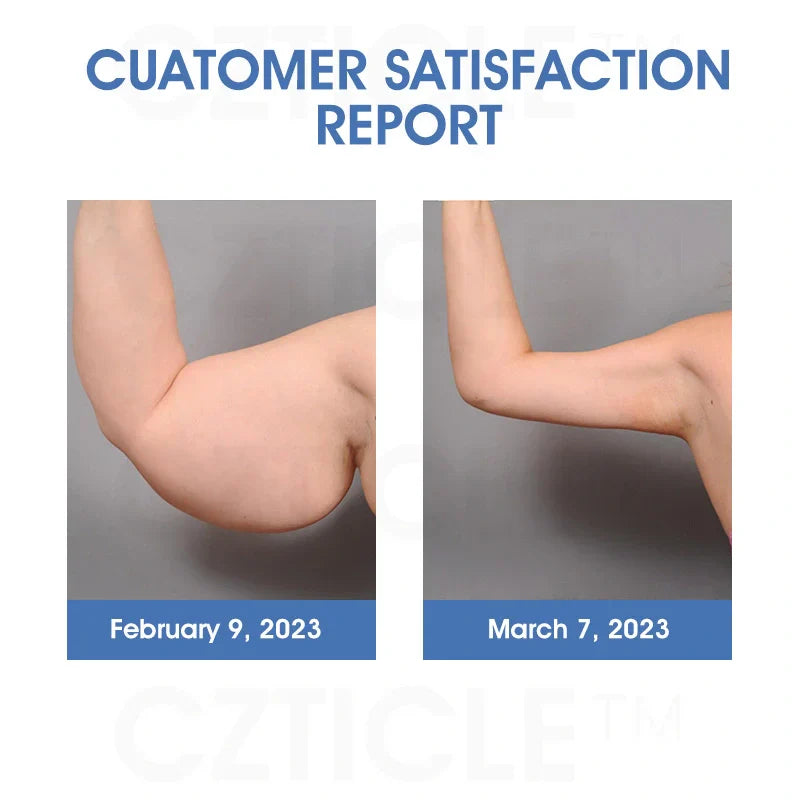 CZTICLE™ Titanium Ion Lymphatic Drainage Watch