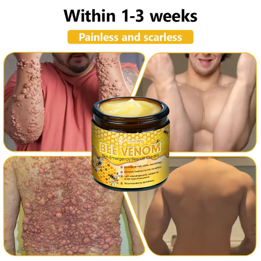 Tnnedey™ Bee Venom Skin Emergency Rescue Cream (AAD Recommended) 💆‍♀️ Expert Recommended for Ultimate Skin Revival ✨