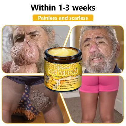 Tnnedey™ Bee Venom Skin Emergency Rescue Cream (AAD Recommended) 💆‍♀️ Expert Recommended for Ultimate Skin Revival ✨