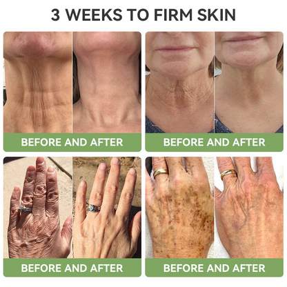 【OFFICIAL STORE】🔥 Last Day to Save 75%! Fubsta® Advanced Firming & Wrinkle-Reducing Cream – Restore Elasticity & Achieve Youthful, Glowing Skin! ⭐
