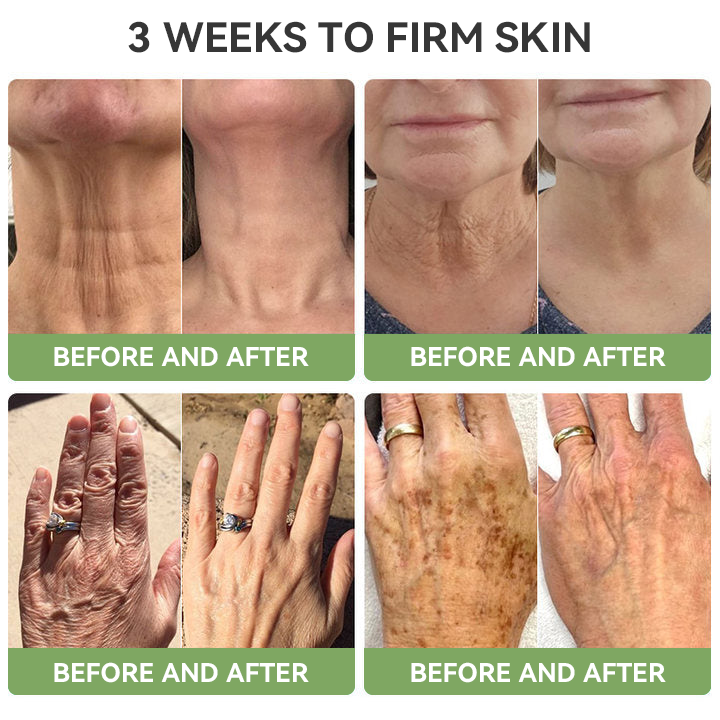 𝐒𝐓𝐃𝐄𝐈™𝐋𝐮𝐱𝐮𝐫𝐢𝐨𝐮𝐬 𝐂𝐨𝐥𝐥𝐚𝐠𝐞𝐧 𝐅𝐢𝐫𝐦𝐢𝐧𝐠 𝐂𝐫𝐞𝐚𝐦(🔥74% Off for a Limited Time!)💥🎁🎁