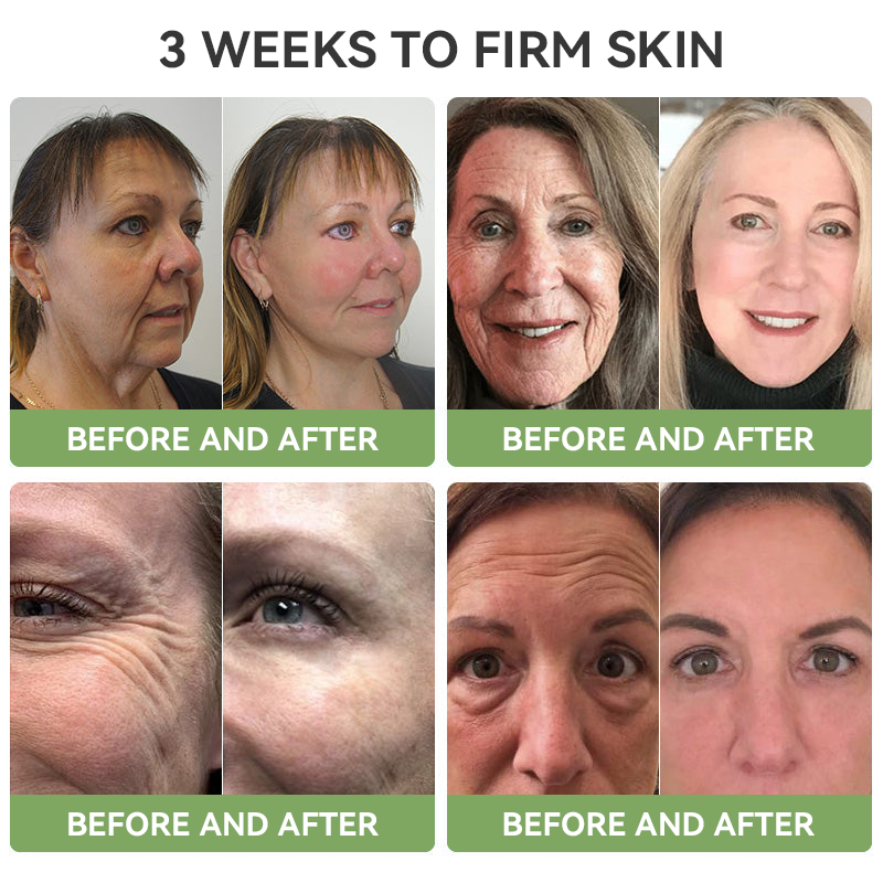【OFFICIAL STORE】🔥 Last Day to Save 75%! Fubsta® Advanced Firming & Wrinkle-Reducing Cream – Restore Elasticity & Achieve Youthful, Glowing Skin! ⭐