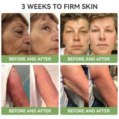 𝐒𝐓𝐃𝐄𝐈™𝐋𝐮𝐱𝐮𝐫𝐢𝐨𝐮𝐬 𝐂𝐨𝐥𝐥𝐚𝐠𝐞𝐧 𝐅𝐢𝐫𝐦𝐢𝐧𝐠 𝐂𝐫𝐞𝐚𝐦(🔥74% Off for a Limited Time!)💥🎁🎁