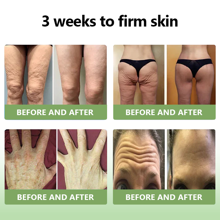 𝐒𝐓𝐃𝐄𝐈™𝐋𝐮𝐱𝐮𝐫𝐢𝐨𝐮𝐬 𝐂𝐨𝐥𝐥𝐚𝐠𝐞𝐧 𝐅𝐢𝐫𝐦𝐢𝐧𝐠 𝐂𝐫𝐞𝐚𝐦(🔥74% Off for a Limited Time!)💥🎁🎁