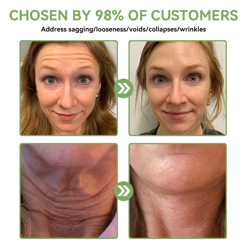𝐒𝐓𝐃𝐄𝐈™𝐋𝐮𝐱𝐮𝐫𝐢𝐨𝐮𝐬 𝐂𝐨𝐥𝐥𝐚𝐠𝐞𝐧 𝐅𝐢𝐫𝐦𝐢𝐧𝐠 𝐂𝐫𝐞𝐚𝐦(🔥74% Off for a Limited Time!)💥🎁🎁