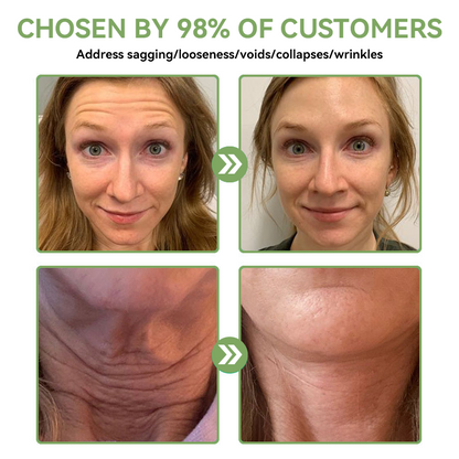 𝐒𝐓𝐃𝐄𝐈™𝐋𝐮𝐱𝐮𝐫𝐢𝐨𝐮𝐬 𝐂𝐨𝐥𝐥𝐚𝐠𝐞𝐧 𝐅𝐢𝐫𝐦𝐢𝐧𝐠 𝐂𝐫𝐞𝐚𝐦(🔥74% Off for a Limited Time!)💥🎁🎁