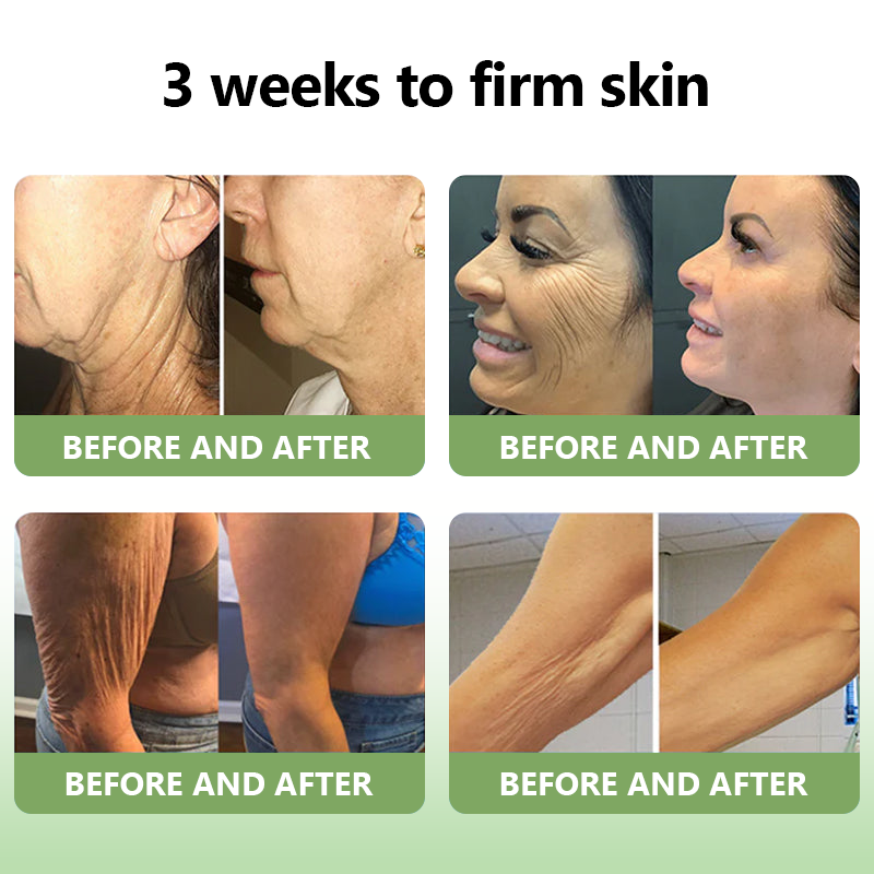 𝐒𝐓𝐃𝐄𝐈™𝐋𝐮𝐱𝐮𝐫𝐢𝐨𝐮𝐬 𝐂𝐨𝐥𝐥𝐚𝐠𝐞𝐧 𝐅𝐢𝐫𝐦𝐢𝐧𝐠 𝐂𝐫𝐞𝐚𝐦(🔥74% Off for a Limited Time!)💥🎁🎁