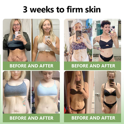 𝐒𝐓𝐃𝐄𝐈™𝐋𝐮𝐱𝐮𝐫𝐢𝐨𝐮𝐬 𝐂𝐨𝐥𝐥𝐚𝐠𝐞𝐧 𝐅𝐢𝐫𝐦𝐢𝐧𝐠 𝐂𝐫𝐞𝐚𝐦(🔥74% Off for a Limited Time!)💥🎁🎁