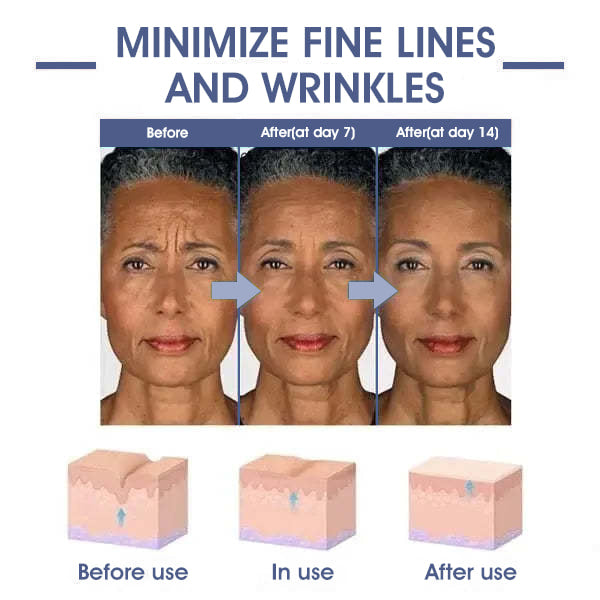 𝐋𝐚𝐬𝐭 𝐃𝐚𝐲 𝐃𝐢𝐬𝐜𝐨𝐮𝐧𝐭: ✨🩵𝟕𝟎% 𝐎𝐅𝐅🌸𝐅𝐮𝐛𝐬𝐭𝐚® 𝐀𝐝𝐯𝐚𝐧𝐜𝐞𝐝 𝐅𝐢𝐫𝐦𝐢𝐧𝐠 & 𝐖𝐫𝐢𝐧𝐤𝐥𝐞-𝐑𝐞𝐝𝐮𝐜𝐢𝐧𝐠 𝐂𝐫𝐞𝐚𝐦: Restore Skin Elasticity⭐