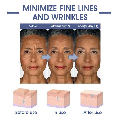 𝐋𝐚𝐬𝐭 𝐃𝐚𝐲 𝐃𝐢𝐬𝐜𝐨𝐮𝐧𝐭: ✨🩵𝟕𝟎% 𝐎𝐅𝐅🌸𝐅𝐮𝐛𝐬𝐭𝐚® 𝐀𝐝𝐯𝐚𝐧𝐜𝐞𝐝 𝐅𝐢𝐫𝐦𝐢𝐧𝐠 & 𝐖𝐫𝐢𝐧𝐤𝐥𝐞-𝐑𝐞𝐝𝐮𝐜𝐢𝐧𝐠 𝐂𝐫𝐞𝐚𝐦: Restore Skin Elasticity⭐