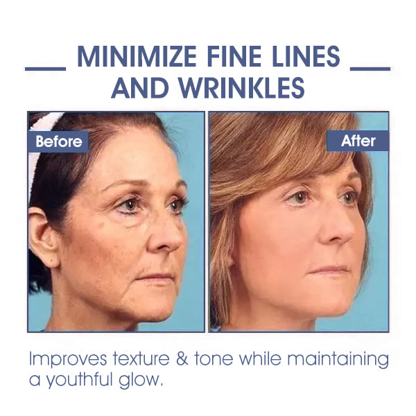 𝐋𝐚𝐬𝐭 𝐃𝐚𝐲 𝐃𝐢𝐬𝐜𝐨𝐮𝐧𝐭: ✨🩵𝟕𝟎% 𝐎𝐅𝐅🌸𝐅𝐮𝐛𝐬𝐭𝐚® 𝐀𝐝𝐯𝐚𝐧𝐜𝐞𝐝 𝐅𝐢𝐫𝐦𝐢𝐧𝐠 & 𝐖𝐫𝐢𝐧𝐤𝐥𝐞-𝐑𝐞𝐝𝐮𝐜𝐢𝐧𝐠 𝐂𝐫𝐞𝐚𝐦: Restore Skin Elasticity⭐