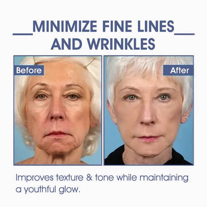 𝐋𝐚𝐬𝐭 𝐃𝐚𝐲 𝐃𝐢𝐬𝐜𝐨𝐮𝐧𝐭: ✨🩵𝟕𝟎% 𝐎𝐅𝐅🌸𝐅𝐮𝐛𝐬𝐭𝐚® 𝐀𝐝𝐯𝐚𝐧𝐜𝐞𝐝 𝐅𝐢𝐫𝐦𝐢𝐧𝐠 & 𝐖𝐫𝐢𝐧𝐤𝐥𝐞-𝐑𝐞𝐝𝐮𝐜𝐢𝐧𝐠 𝐂𝐫𝐞𝐚𝐦: Restore Skin Elasticity⭐