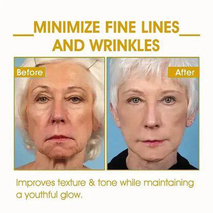 𝐋𝐚𝐬𝐭 𝐃𝐚𝐲 𝐃𝐢𝐬𝐜𝐨𝐮𝐧𝐭: 75% 𝐎𝐅𝐅✨𝐅𝐮𝐛𝐬𝐭𝐚® SkinFirming Rejuvenating Oil 💛