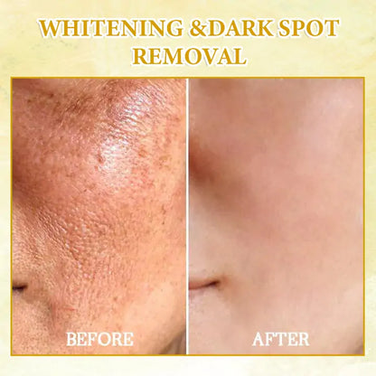𝐋𝐚𝐬𝐭 𝐃𝐚𝐲 𝐃𝐢𝐬𝐜𝐨𝐮𝐧𝐭: 75% 𝐎𝐅𝐅✨𝐅𝐮𝐛𝐬𝐭𝐚® SkinFirming Rejuvenating Oil 💛