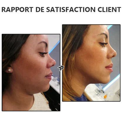 CZTICLE® Lymphatic Magnetotherapy with Germanium✨✨