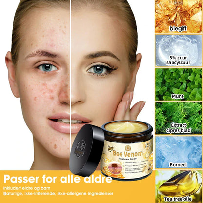 [Offisiell nettside] 𝐓𝐧𝐧𝐞𝐝𝐞𝐲®  Biegift Hudbehandlingskrem er godkjent av NFDV (Hjelper mot akne, vorter, rosacea, psoriasis, aldersflekker, eksem og reduserer synligheten av strekkmerker)🌿