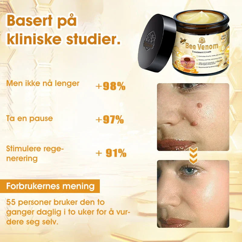 [Offisiell nettside] 𝐓𝐧𝐧𝐞𝐝𝐞𝐲®  Biegift Hudbehandlingskrem er godkjent av NFDV (Hjelper mot akne, vorter, rosacea, psoriasis, aldersflekker, eksem og reduserer synligheten av strekkmerker)🌿