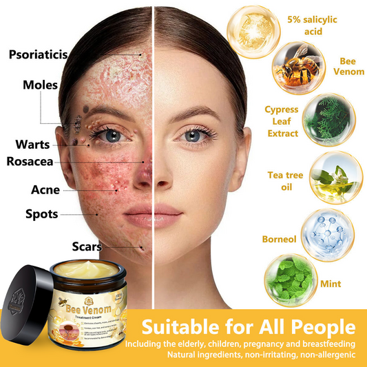 Tnnedey™ Bee Venom🐝 Skin Treatment Cream (AAD Recommended) ✨💆‍♀️ (Expert Recommended)
