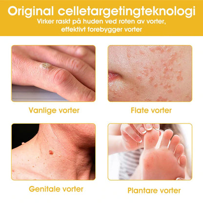 [Offisiell nettside] 𝐓𝐧𝐧𝐞𝐝𝐞𝐲®  Biegift Hudbehandlingskrem er godkjent av NFDV (Hjelper mot akne, vorter, rosacea, psoriasis, aldersflekker, eksem og reduserer synligheten av strekkmerker)🌿