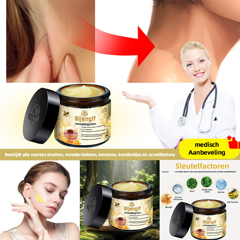 [Offisiell nettside] 𝐓𝐧𝐧𝐞𝐝𝐞𝐲®  Biegift Hudbehandlingskrem er godkjent av NFDV (Hjelper mot akne, vorter, rosacea, psoriasis, aldersflekker, eksem og reduserer synligheten av strekkmerker)🌿