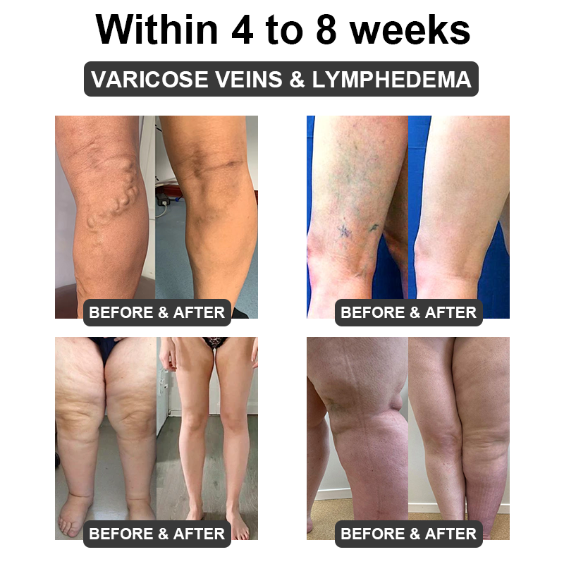 𝐅𝐮𝐭𝐮𝐬𝐥𝐲™ 𝐔𝐥𝐭𝐫𝐚𝐬𝐨𝐧𝐢𝐜 𝐂𝐚𝐯𝐢𝐭𝐚𝐭𝐢𝐨𝐧 & 𝐃𝐞𝐭𝐨𝐱𝐢𝐟𝐢𝐜𝐚𝐭𝐢𝐨𝐧 𝐖𝐫𝐢𝐬𝐭𝐛𝐚𝐧𝐝 (👨‍⚕️𝐑𝐞𝐜𝐨𝐦𝐦𝐞𝐧𝐝𝐞𝐝 𝐛𝐲 𝐏𝐥𝐚𝐬𝐭𝐢𝐜 𝐒𝐮𝐫𝐠𝐞𝐨𝐧𝐬)