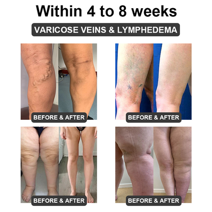 𝐅𝐮𝐭𝐮𝐬𝐥𝐲™ 𝐔𝐥𝐭𝐫𝐚𝐬𝐨𝐧𝐢𝐜 𝐂𝐚𝐯𝐢𝐭𝐚𝐭𝐢𝐨𝐧 & 𝐃𝐞𝐭𝐨𝐱𝐢𝐟𝐢𝐜𝐚𝐭𝐢𝐨𝐧 𝐖𝐫𝐢𝐬𝐭𝐛𝐚𝐧𝐝 (👨‍⚕️𝐑𝐞𝐜𝐨𝐦𝐦𝐞𝐧𝐝𝐞𝐝 𝐛𝐲 𝐏𝐥𝐚𝐬𝐭𝐢𝐜 𝐒𝐮𝐫𝐠𝐞𝐨𝐧𝐬)