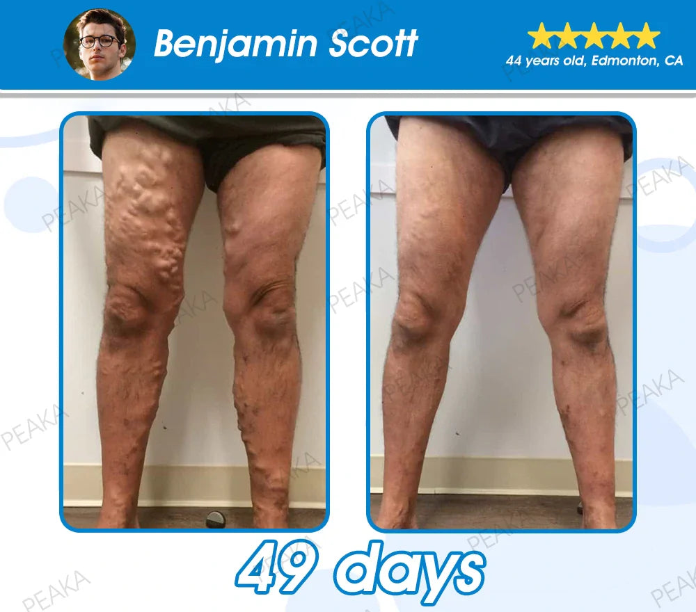 𝐎𝐟𝐟𝐢𝐜𝐢𝐚𝐥 𝐂𝐀𝐍𝐀𝐃𝐀 𝐒𝐭𝐨𝐫𝐞 | 𝐏𝐄𝐀𝐊𝐀® 𝐆𝐋𝐏-𝟏 𝐒𝐥𝐢𝐦𝐦𝐢𝐧𝐠 𝐋𝐢𝐪𝐮𝐢𝐝 𝐏𝐞𝐚𝐫𝐥𝐬 – 𝐖𝐢𝐭𝐡 𝐍𝐀𝐃+, 𝐌𝐨𝐫𝐢𝐧𝐠𝐚, 𝐀𝐩𝐩𝐥𝐞 𝐂𝐢𝐝𝐞𝐫 𝐕𝐢𝐧𝐞𝐠𝐚𝐫 & 𝐊𝐞𝐭𝐨 𝐁𝐇𝐁 | 𝐅𝐚𝐬𝐭-𝐀𝐜𝐭𝐢𝐧𝐠, 𝐄𝐱𝐩𝐞𝐫𝐭-𝐃𝐞𝐯𝐞𝐥𝐨𝐩𝐞𝐝 𝐅𝐨𝐫𝐦𝐮𝐥𝐚 𝐟𝐨𝐫 𝐖𝐞𝐢𝐠𝐡𝐭 & 𝐇𝐞𝐚𝐥𝐭𝐡 𝐒𝐮𝐩𝐩𝐨𝐫𝐭