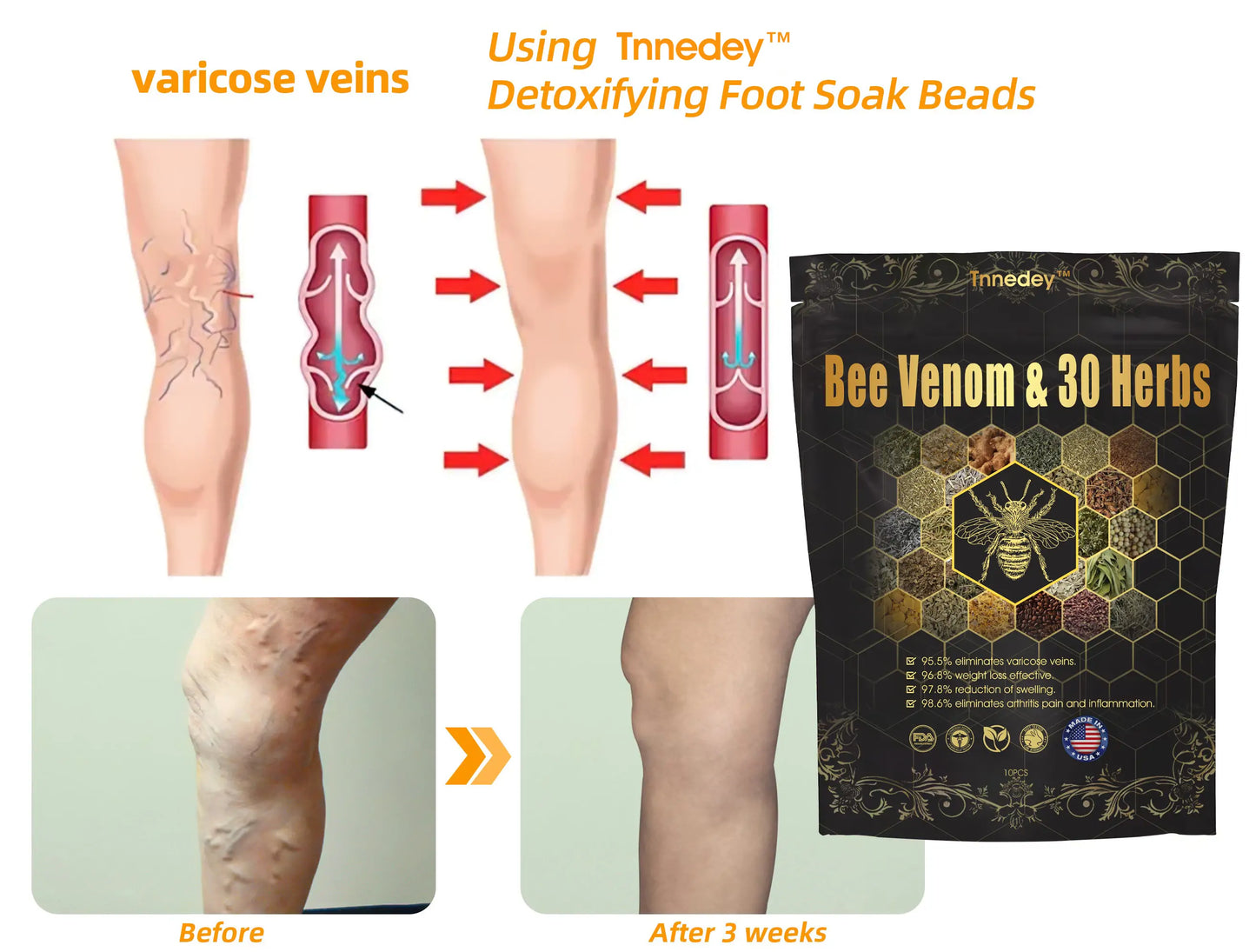 𝐂𝐡𝐫𝐢𝐬𝐭𝐦𝐚𝐬 𝐒𝐩𝐞𝐜𝐢𝐚𝐥: Tnnedey® Bee Venom & 30-Herb Detox Foot Soak Beads for 𝐁𝐨𝐝𝐲 𝐒𝐜𝐮𝐥𝐩𝐭𝐢𝐧𝐠 Recommended by the America 𝐋𝐲𝐦𝐩𝐡𝐚𝐭𝐢𝐜 Academy (ALA) 🎄✨
