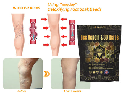𝐂𝐡𝐫𝐢𝐬𝐭𝐦𝐚𝐬 𝐒𝐩𝐞𝐜𝐢𝐚𝐥: Tnnedey® Bee Venom & 30-Herb Detox Foot Soak Beads for 𝐁𝐨𝐝𝐲 𝐒𝐜𝐮𝐥𝐩𝐭𝐢𝐧𝐠 Recommended by the America 𝐋𝐲𝐦𝐩𝐡𝐚𝐭𝐢𝐜 Academy (ALA) 🎄✨