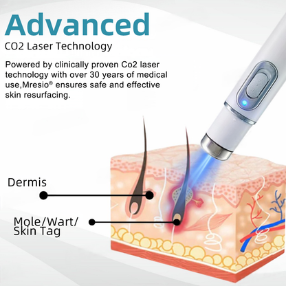 Clinically Reviewed by Mayo Clinic Experts: 👩‍⚕️Mresio® 𝑵on-i𝒏va𝒔𝒊ve 𝑴o𝒍e an𝒅 𝑾ar𝒕 𝑹emo𝒗𝒂𝒍 𝑳ase𝒓 𝑷en 𝑷roma𝒙 (Fast and painless removal of warts. moles. age spots. and skin tags — completely without side effects.)🚀