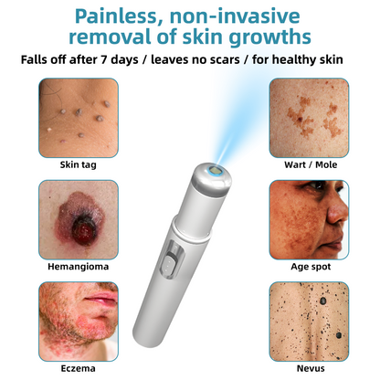 Clinically Reviewed by Mayo Clinic Experts: 👩‍⚕️Mresio® 𝑵on-i𝒏va𝒔𝒊ve 𝑴o𝒍e an𝒅 𝑾ar𝒕 𝑹emo𝒗𝒂𝒍 𝑳ase𝒓 𝑷en 𝑷roma𝒙 (Fast and painless removal of warts. moles. age spots. and skin tags — completely without side effects.)🚀