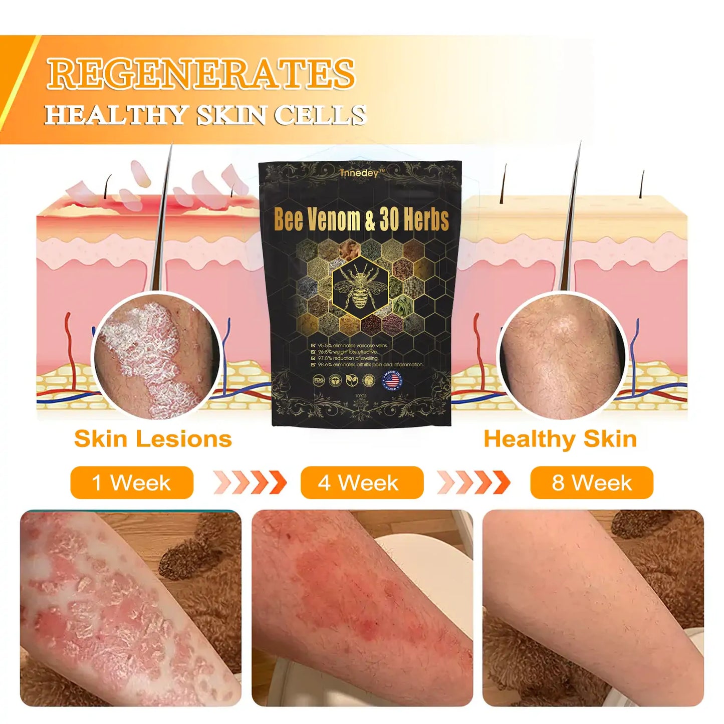 𝐂𝐡𝐫𝐢𝐬𝐭𝐦𝐚𝐬 𝐒𝐩𝐞𝐜𝐢𝐚𝐥: Tnnedey® Bee Venom & 30-Herb Detox Foot Soak Beads for 𝐁𝐨𝐝𝐲 𝐒𝐜𝐮𝐥𝐩𝐭𝐢𝐧𝐠 Recommended by the America 𝐋𝐲𝐦𝐩𝐡𝐚𝐭𝐢𝐜 Academy (ALA) 🎄✨