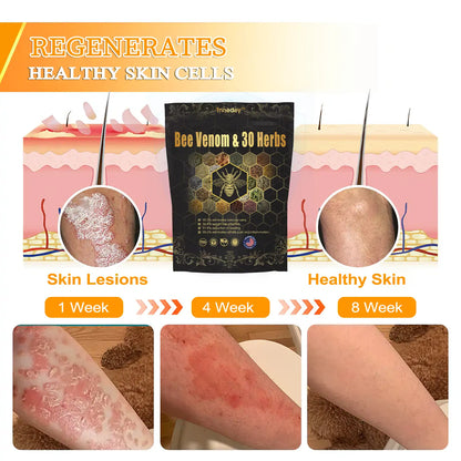 𝐂𝐡𝐫𝐢𝐬𝐭𝐦𝐚𝐬 𝐒𝐩𝐞𝐜𝐢𝐚𝐥: Tnnedey® Bee Venom & 30-Herb Detox Foot Soak Beads for 𝐁𝐨𝐝𝐲 𝐒𝐜𝐮𝐥𝐩𝐭𝐢𝐧𝐠 Recommended by the America 𝐋𝐲𝐦𝐩𝐡𝐚𝐭𝐢𝐜 Academy (ALA) 🎄✨