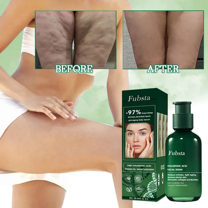 Last Day Promotion 80%OFF -Fubsta™SkinFirming Rejuvenating Serum
