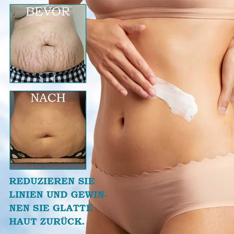 𝐋𝐚𝐬𝐭 𝐃𝐚𝐲 𝐃𝐢𝐬𝐜𝐨𝐮𝐧𝐭: ✨🩵𝟕𝟎% 𝐎𝐅𝐅🌸𝐅𝐮𝐛𝐬𝐭𝐚® 𝐀𝐝𝐯𝐚𝐧𝐜𝐞𝐝 𝐅𝐢𝐫𝐦𝐢𝐧𝐠 & 𝐖𝐫𝐢𝐧𝐤𝐥𝐞-𝐑𝐞𝐝𝐮𝐜𝐢𝐧𝐠 𝐂𝐫𝐞𝐚𝐦: Restore Skin Elasticity⭐