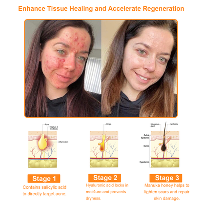 𝐓𝐧𝐧𝐞𝐝𝐞𝐲® 7-Day Multi-Effect All-in-One Skincare Cream [AAD Recommended]🧖‍♀️🌻
