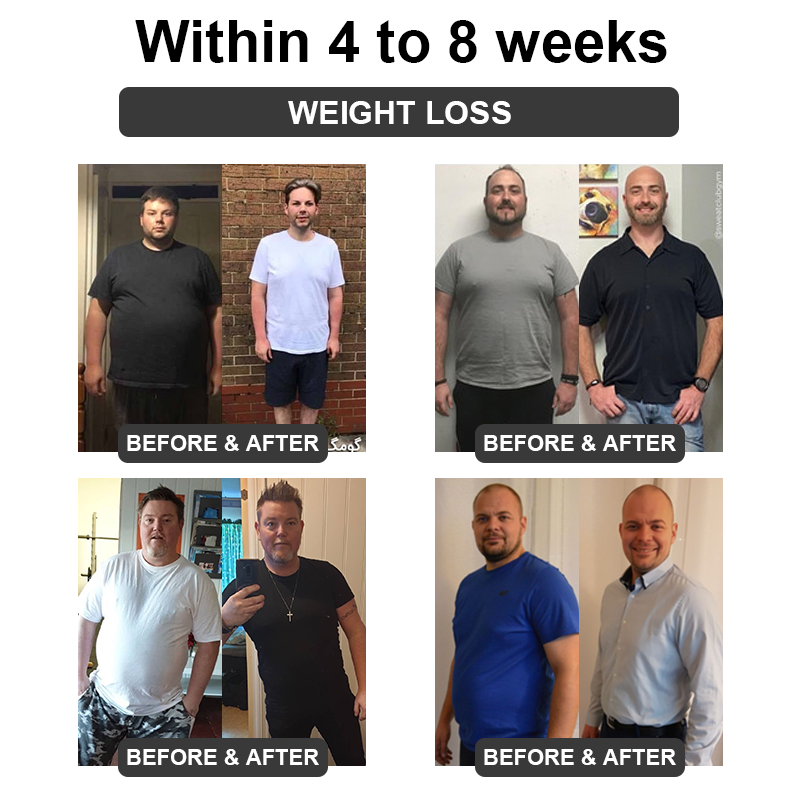 𝐅𝐮𝐭𝐮𝐬𝐥𝐲™ 𝐔𝐥𝐭𝐫𝐚𝐬𝐨𝐧𝐢𝐜 𝐂𝐚𝐯𝐢𝐭𝐚𝐭𝐢𝐨𝐧 & 𝐃𝐞𝐭𝐨𝐱𝐢𝐟𝐢𝐜𝐚𝐭𝐢𝐨𝐧 𝐖𝐫𝐢𝐬𝐭𝐛𝐚𝐧𝐝 (👨‍⚕️𝐑𝐞𝐜𝐨𝐦𝐦𝐞𝐧𝐝𝐞𝐝 𝐛𝐲 𝐏𝐥𝐚𝐬𝐭𝐢𝐜 𝐒𝐮𝐫𝐠𝐞𝐨𝐧𝐬)