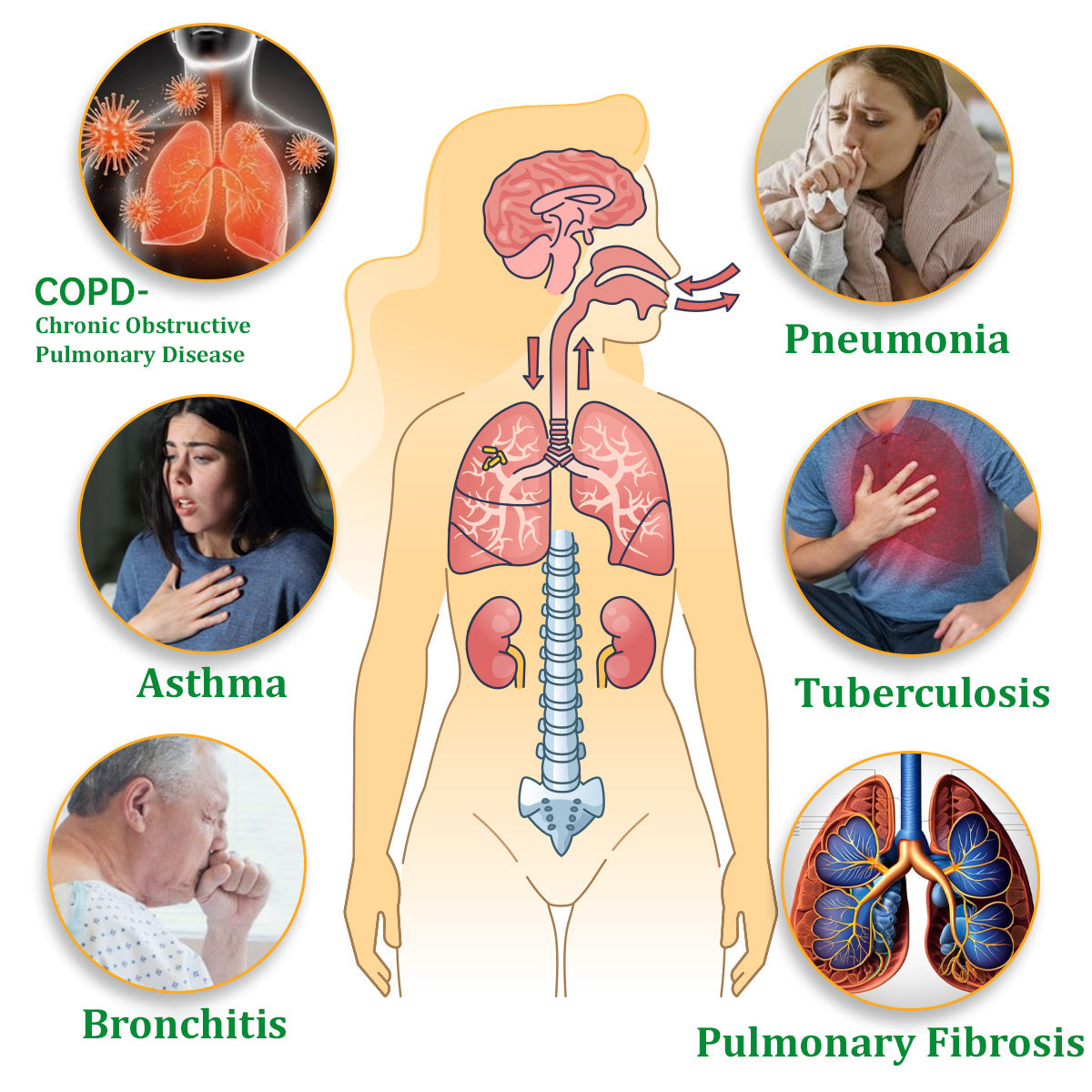 💖✅Official Store:tnnedey™ Herbal Lung Cleansing Inhaler (💝 Cough, wheezing, shortness of breath, sputum, stuffy nose, bronchitis, bronchitis, allergy symptoms, lung discomfort💝)