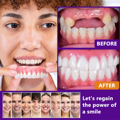𝐁𝐢𝐤𝐞𝐧𝐝𝐚™ Silicone Reline Denture Set (⏰ Limited Time Discount Last 30 Minutes ⏰)CED🦷