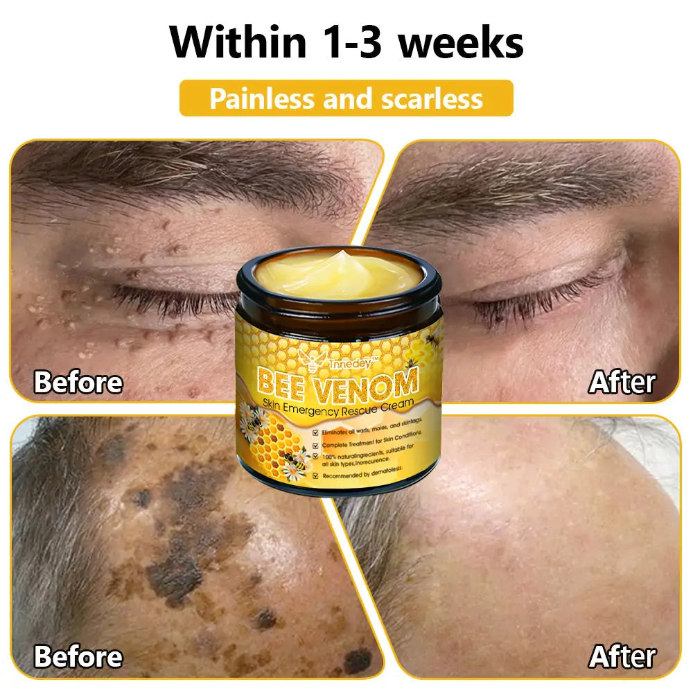 Tnnedey™ Bee Venom Skin Emergency Rescue Cream (AAD Recommended) 💆‍♀️ Expert Recommended for Ultimate Skin Revival ✨