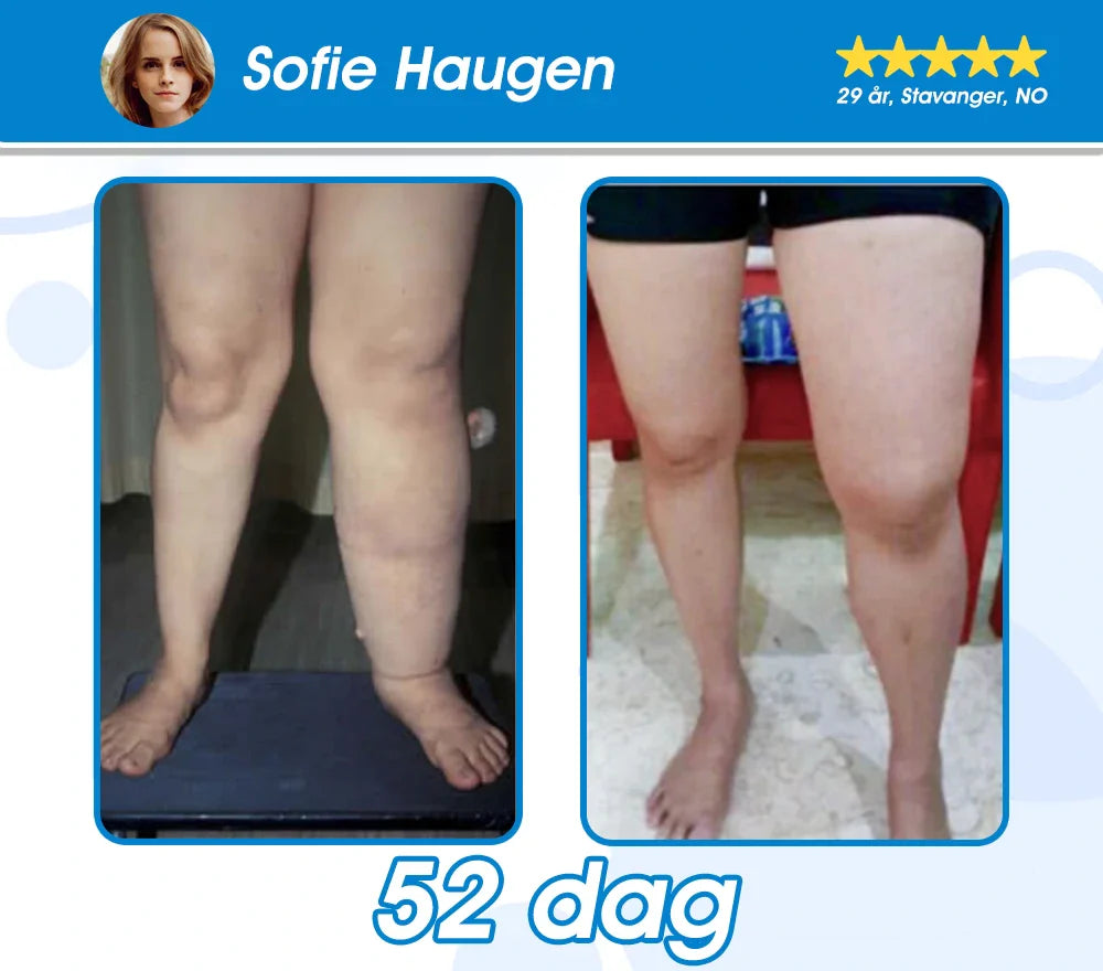 Offisielt autorisert butikk -𝘗𝘌𝘈𝘒𝘈® 𝘎𝘓𝘗-1 𝘚𝘭𝘢𝘯𝘬𝘦𝘯𝘥𝘦 & 𝘏𝘦𝘭𝘴𝘦 𝘜𝘭𝘵𝘳𝘢 𝘒𝘰𝘯𝘴𝘦𝘯𝘵𝘳𝘦𝘳𝘵 𝘌𝘴𝘴𝘦𝘯𝘴𝘷æ𝘴𝘬𝘦𝘱𝘦𝘳𝘭𝘦𝘳 – 𝘕𝘈𝘋+ 𝘔𝘰𝘳𝘪𝘯𝘨𝘢 & 𝘌𝘱𝘭𝘦𝘤𝘪𝘥𝘦𝘳𝘦𝘥𝘥𝘪𝘬 & 𝘒𝘦𝘵𝘰 𝘉𝘏𝘉 (✅ rask, langvarig effekt, adresserer diabetes, fedme og hjerte- og karsykdommer) ⚡Utviklet av The Obesity Society
